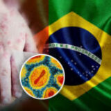 Brasil: aumento de 300% de casos de viruela del mono